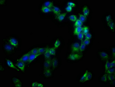 ADAM10 Antibody - Immunofluorescence staining of Hela cells with ADAM10 Antibody at 1:133, counter-stained with DAPI. The cells were fixed in 4% formaldehyde, permeabilized using 0.2% Triton X-100 and blocked in 10% normal Goat Serum. The cells were then incubated with the antibody overnight at 4°C. The secondary antibody was Alexa Fluor 488-congugated AffiniPure Goat Anti-Rabbit IgG(H+L).