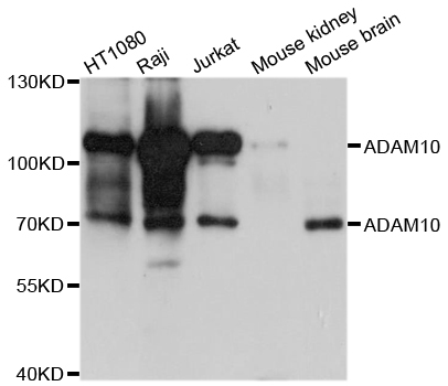 ADAM10 Antibody - Western blot analysis of extracts of various cell lines, using ADAM10 antibody at 1:1000 dilution. The secondary antibody used was an HRP Goat Anti-Rabbit IgG (H+L) at 1:10000 dilution. Lysates were loaded 25ug per lane and 3% nonfat dry milk in TBST was used for blocking. An ECL Kit was used for detection and the exposure time was 30s.