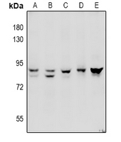 ADAM10 Antibody - Western blot analysis of ADAM10 expression in HepG2 (A), U87MG (B), A549 (C), SP20 (D), PC12 (E) whole cell lysates.