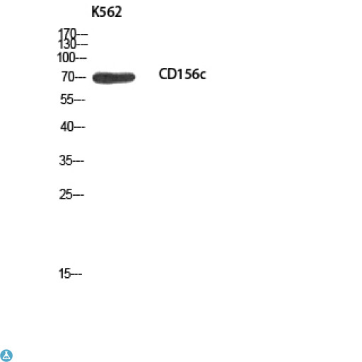 ADAM10 Antibody - Immunohistochemistry (IHC) analysis of paraffin-embedded Human Lymph, antibody was diluted at 1:100.