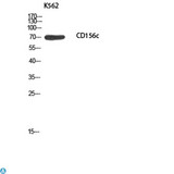 ADAM10 Antibody - Immunohistochemistry (IHC) analysis of paraffin-embedded Human Lymph, antibody was diluted at 1:100.