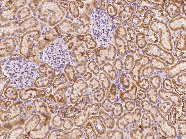 ADAM10 Antibody - Immunochemical staining of rat ADAM10 in rat kidney with rabbit polyclonal antibody at 1:1000 dilution, formalin-fixed paraffin embedded sections.