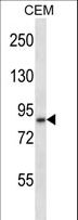 ADAM11 Antibody - ADAM11 Antibody western blot of CEM cell line lysates (35 ug/lane). The ADAM11 antibody detected the ADAM11 protein (arrow).