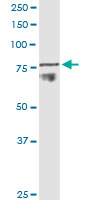 ADAM11 Antibody - ADAM11 monoclonal antibody (M01), clone 3D4. Western Blot analysis of ADAM11 expression in human colon.