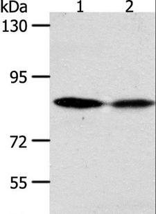 ADAM11 Antibody - Western blot analysis of HeLa and SKOV3 cell, using ADAM11 Polyclonal Antibody at dilution of 1:500.