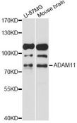 ADAM11 Antibody - Western blot analysis of extracts of various cell lines, using ADAM11 antibody at 1:1000 dilution. The secondary antibody used was an HRP Goat Anti-Rabbit IgG (H+L) at 1:10000 dilution. Lysates were loaded 25ug per lane and 3% nonfat dry milk in TBST was used for blocking. An ECL Kit was used for detection and the exposure time was 15s.