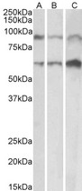 ADAM12 Antibody - Goat Anti-ADAM12 (aa225-239) Antibody (0.1µg/ml) staining of Mouse (A), Rat (B) and Pig (C) Heart lysate (35µg protein in RIPA buffer). Primary incubation was 1 hour. Detected by chemiluminescencence.