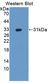ADAM12 Antibody - Western blot of ADAM12 antibody.