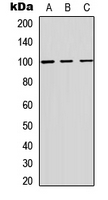 ADAM12 Antibody - Western blot analysis of ADAM12 expression in HEK293T (A); Raw264.7 (B); H9C2 (C) whole cell lysates.
