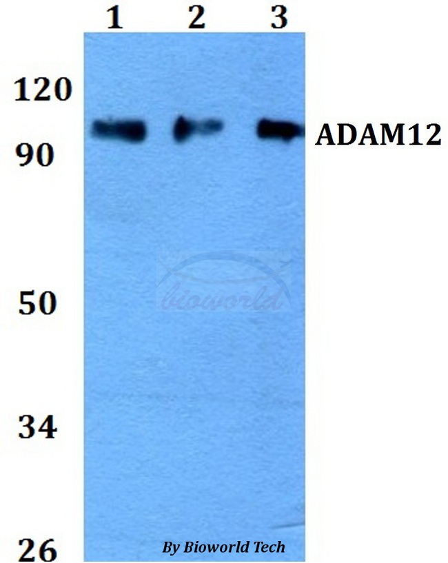 ADAM12 Antibody - Western blot of ADAM12 antibody at 1:500 dilution. Lane 1: HEK293T whole cell lysate. Lane 2: Raw264.7 whole cell lysate. Lane 3: H9C2 whole cell lysate.