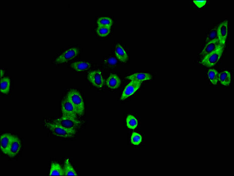 ADAM12 Antibody - Immunofluorescent analysis of HepG2 cells using ADAM12 Antibody at a dilution of 1:100 and Alexa Fluor 488-congugated AffiniPure Goat Anti-Rabbit IgG(H+L)