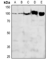ADAM12 Antibody - Western blot analysis of ADAM12-L expression in PC3 (A), HCT116 (B), U87MG (C), mouse brain (D), rat brain (E) whole cell lysates.