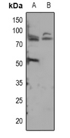ADAM12 Antibody - Western blot analysis of ADAM12-S expression in mouse brain (A), rat brain (B) whole cell lysates.