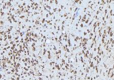 ADAM12 Antibody - 1:100 staining mouse brain tissue by IHC-P. The sample was formaldehyde fixed and a heat mediated antigen retrieval step in citrate buffer was performed. The sample was then blocked and incubated with the antibody for 1.5 hours at 22°C. An HRP conjugated goat anti-rabbit antibody was used as the secondary.