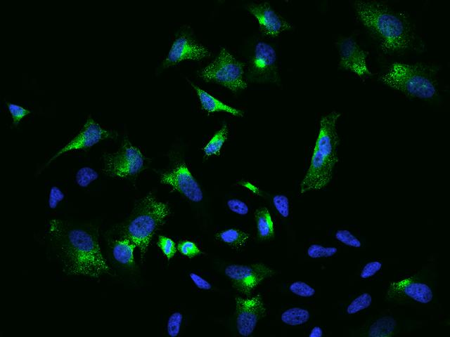 ADAM12 Antibody - Immunofluorescence staining of ADAM12 in Hela cells. Cells were fixed with 4% PFA, blocked with 10% serum, and incubated with rabbit anti-Human ADAM12 polyclonal antibody (dilution ratio 1:200) at 4°C overnight. Then cells were stained with the Alexa Fluor 488-conjugated Goat Anti-rabbit IgG secondary antibody (green) and counterstained with DAPI (blue). Positive staining was localized to Cytoplasm.