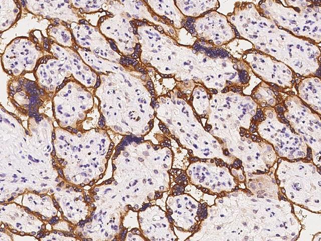 ADAM12 Antibody - Immunochemical staining of human ADAM12 in human placenta with rabbit polyclonal antibody at 1:100 dilution, formalin-fixed paraffin embedded sections.