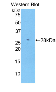 ADAM15 Antibody - Western blot of recombinant ADAM15.  This image was taken for the unconjugated form of this product. Other forms have not been tested.