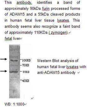 ADAM15 Antibody