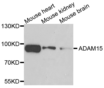 ADAM15 Antibody - Western blot analysis of extracts of various cells.
