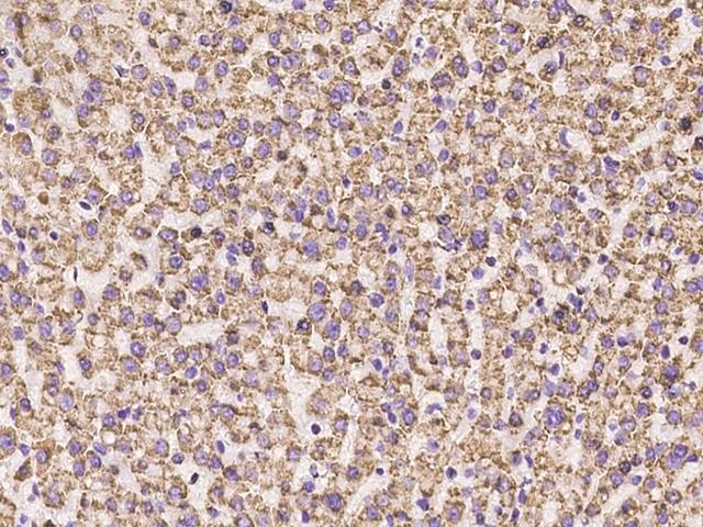 ADAM15 Antibody - Immunochemical staining of human ADAM15 in human liver with rabbit polyclonal antibody at 1:100 dilution, formalin-fixed paraffin embedded sections.