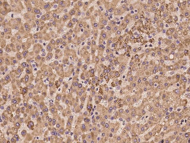 ADAM15 Antibody - Immunochemical staining of human ADAM15 in human liver with rabbit polyclonal antibody at 1:100 dilution, formalin-fixed paraffin embedded sections.