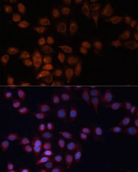 ADAM15 Antibody - Immunofluorescence analysis of HeLa cells using ADAM15 Polyclonal Antibody at dilution of 1:100 (40x lens).Blue: DAPI for nuclear staining.