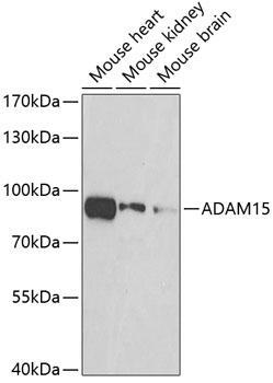 ADAM15 Antibody - Western blot analysis of extracts of various cell lines using ADAM15 Polyclonal Antibody at dilution of 1:500.