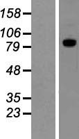 ADAM15 Protein - Western validation with an anti-DDK antibody * L: Control HEK293 lysate R: Over-expression lysate