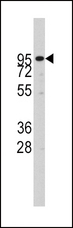 ADAM17 / TACE Antibody - Western blot of ADAM17 Antibody in CEM cell line lysates (35 ug/lane). ADAM17 (arrow) was detected using the purified antibody.