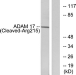 ADAM17 / TACE Antibody - Western blot of extracts from rat liver cells, using ADAM 17 (Cleaved-Arg215) Antibody. The lane on the right is treated with the synthesized peptide.