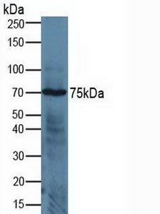 ADAM17 / TACE Antibody - Western Blot; Sample: Human Jurkat Cells.