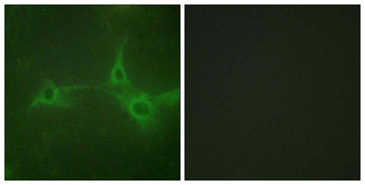ADAM17 / TACE Antibody - Immunofluorescence analysis of NIH/3T3 cells, using ADAM 17 Antibody. The picture on the right is blocked with the synthesized peptide.