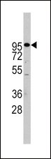 ADAM17 / TACE Antibody - Western blot of ADAM17 Antibody in Jurkat cell line lysates (35 ug/lane). ADAM17(arrow) was detected using the purified antibody.