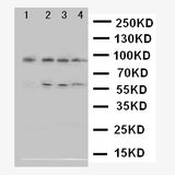 ADAM17 / TACE Antibody - WB of ADAM17 / TACE antibody. Lane 1: Human Placenta Tissue Lysate. Lane 2: HELA Cell Lysate. Lane 3: PANC Cell Lysate. Lane 4: 293T Cell Lysate ..