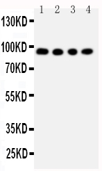 ADAM17 / TACE Antibody - Anti-ADAM17 antibody, Western blotting Lane 1: Human Placenta Tissue LysateLane 2: HELA Cell LysateLane 3: PANC Cell LysateLane 4: 293T Cell Lysate