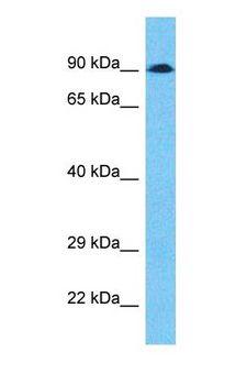 ADAM17 / TACE Antibody - Western blot of ADAM17 Antibody with human 786-0 Whole Cell lysate.  This image was taken for the unconjugated form of this product. Other forms have not been tested.