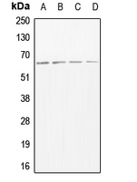 ADAM17 / TACE Antibody - Western blot analysis of CD156b expression in MCF7 (A); mouse heart (B); rat muscle (C); rat heart (D) whole cell lysates.
