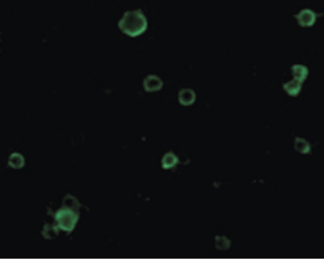 ADAM17 / TACE Antibody - Immunofluorescence of TACE in HeLa cells with TACE antibody at 10 ug/ml.