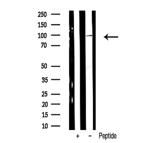 ADAM17 / TACE Antibody - Western blot analysis of ADAM 17 expression in HT1080 whole cells lysates.