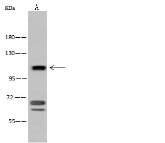 ADAM17 / TACE Antibody - Anti-ADAM17 rabbit polyclonal antibody at 1:500 dilution. Lane A: Jurkat Whole Cell Lysate. Lysates/proteins at 30 ug per lane. Secondary: Goat Anti-Rabbit IgG (H+L)/HRP at 1/10000 dilution. Developed using the ECL technique. Performed under reducing conditions. Predicted band size: 93 kDa.