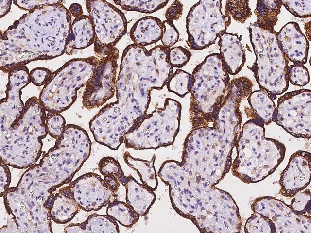 ADAM17 / TACE Antibody - Immunochemical staining of human ADAM17 in human placenta with rabbit polyclonal antibody at 1:100 dilution, formalin-fixed paraffin embedded sections.
