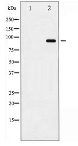 ADAM17 / TACE Antibody - Western blot of ADAM 17 phosphorylation expression in K562UV treated whole cell lysates,The lane on the left is treated with the antigen-specific peptide.