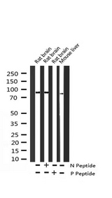 ADAM17 / TACE Antibody - Western blot analysis of Phospho-ADAM 17 (Thr735) expression in various lysates