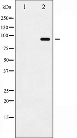 ADAM17 / TACE Antibody - Western blot analysis of ADAM 17 phosphorylation expression in K562UV treated whole cells lysates. The lane on the left is treated with the antigen-specific peptide.