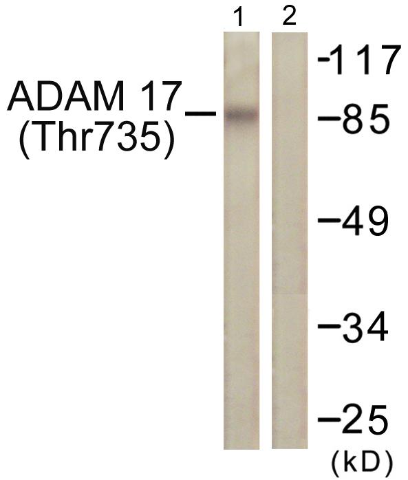 ADAM17 / TACE Antibody - Western blot analysis of extracts from K562 cells, treated with UV (5mins), using ADAM 17 (Phospho-Thr735) antibody.