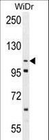 ADAM19 Antibody - Western blot of ADAM19 Antibody in WiDr cell line lysates (35 ug/lane). ADAM19 (arrow) was detected using the purified antibody.