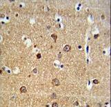 ADAM19 Antibody - ADAM19 Antibody IHC of formalin-fixed and paraffin-embedded brain tissue followed by peroxidase-conjugated secondary antibody and DAB staining.