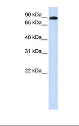 ADAM19 Antibody - Fetal muscle lysate. Antibody concentration: 1.0 ug/ml. Gel concentration: 12%.  This image was taken for the unconjugated form of this product. Other forms have not been tested.