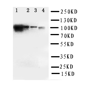ADAM19 Antibody - WB of ADAM19 antibody. Lane 1: Rat Spleen Tissue Lysate. Lane 2: Rat Intestine Tissue Lysate. Lane 3: Rat Brain Tissue Lysate. Lane 4: HELA Cell Lysate.