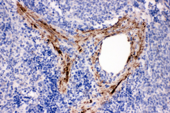 ADAM19 Antibody - ADAM19 antibody. IHC(P): Rat Spleen Tissue.